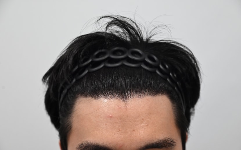 후