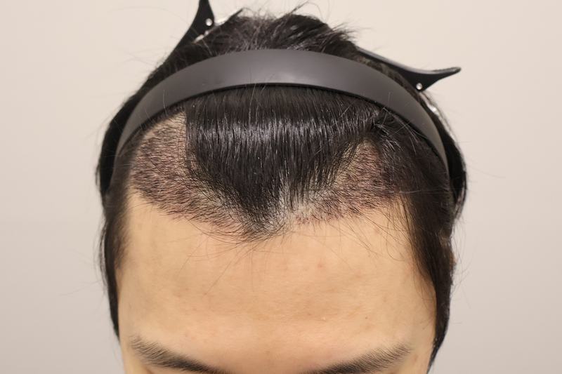 4.png
