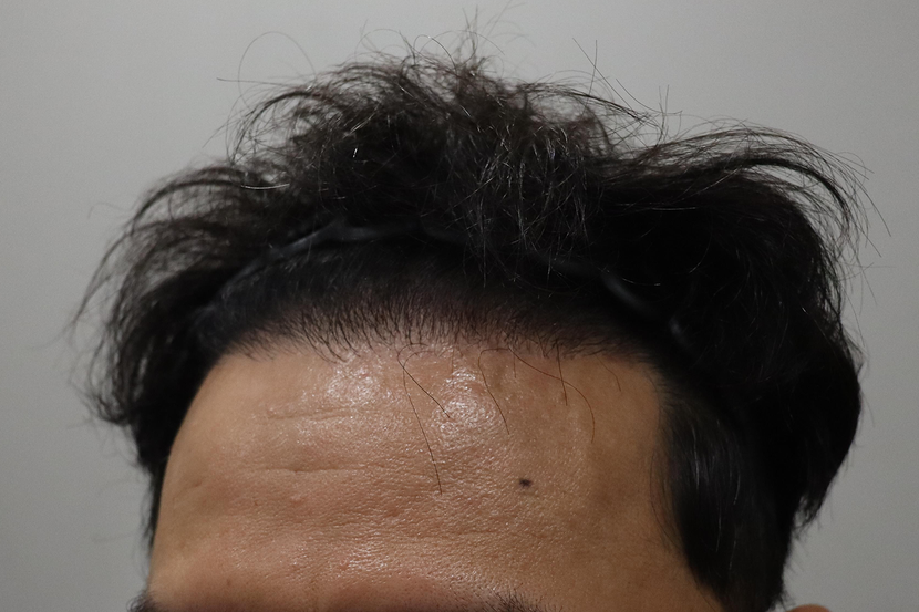 1년차