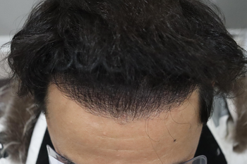 1년차