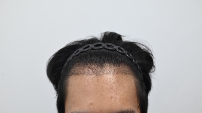 3개월 차