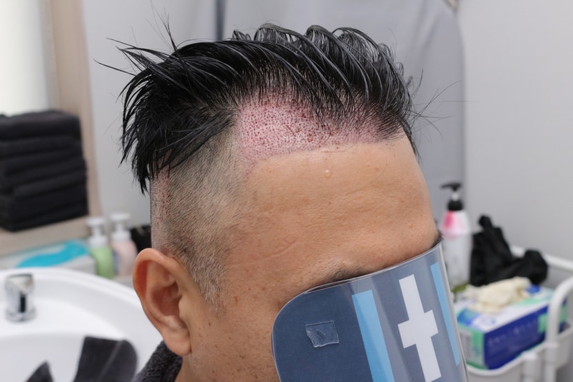 수술다음날