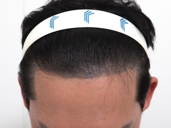 수술전