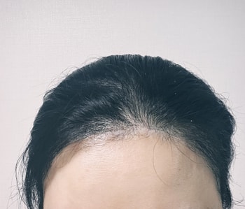 4개월 정면