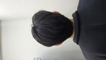 <수술 1일차_뒷면>