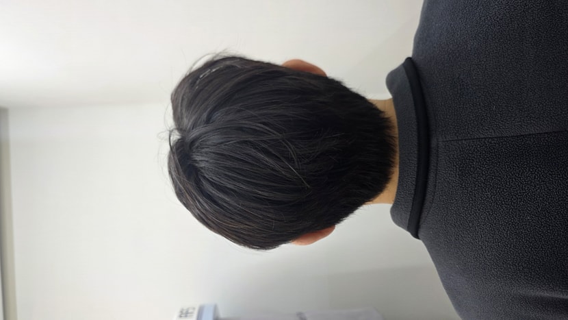 <수술 1일차_뒷면>