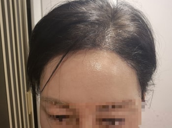 4개월후