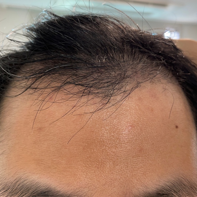 after3month_frontview.jpg