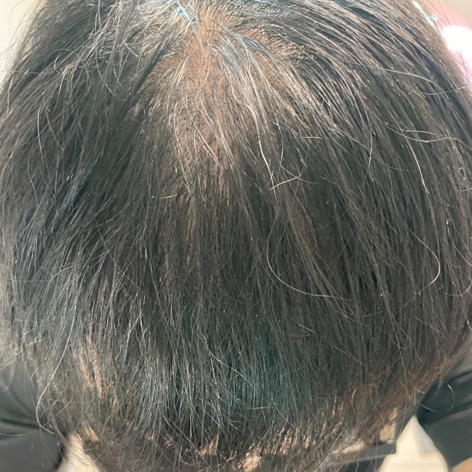 after3month_topview.jpg