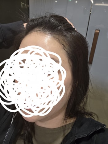 수술전 라인만 그린 상태