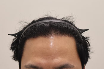 수술후