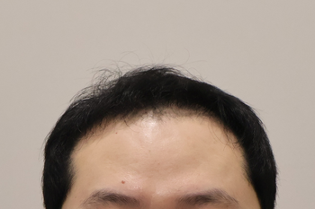 수술후