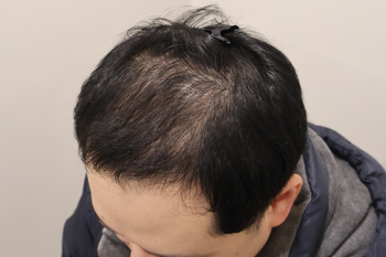 수술후