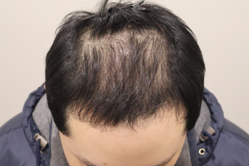 수술후