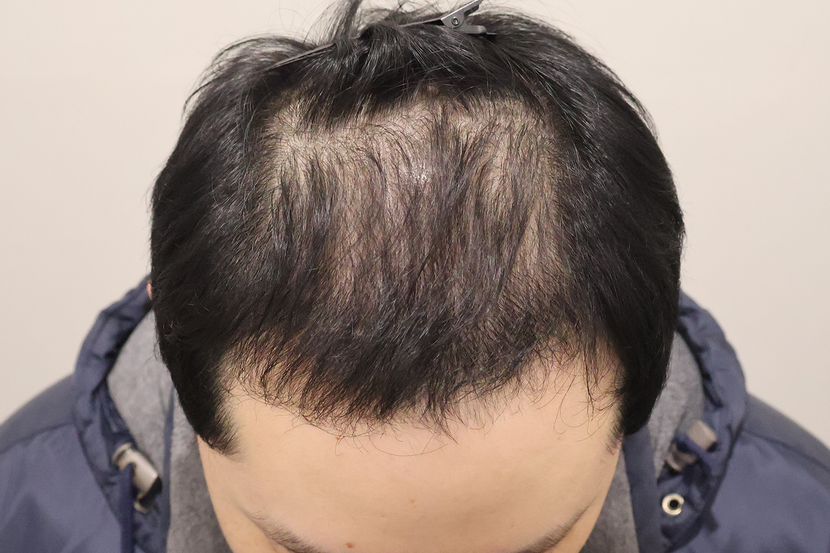 수술후