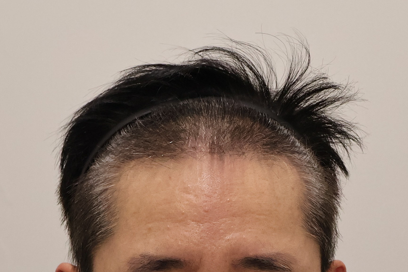 3개월
