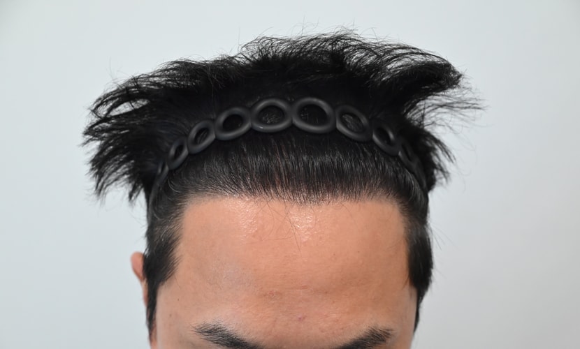 1년
