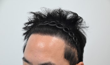 1년