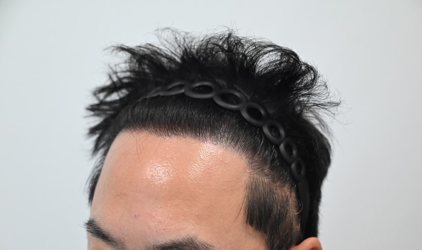 1년