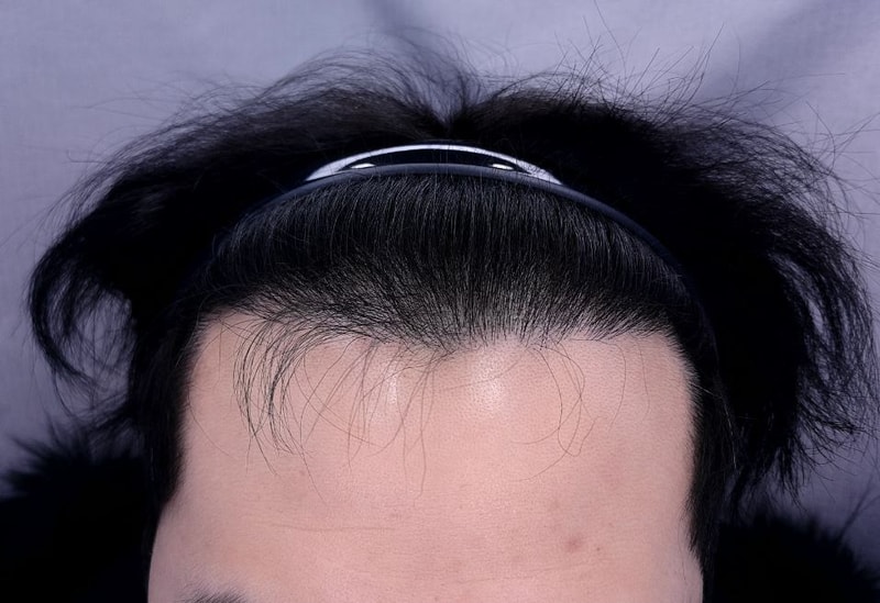 허진강 9개월.JPG