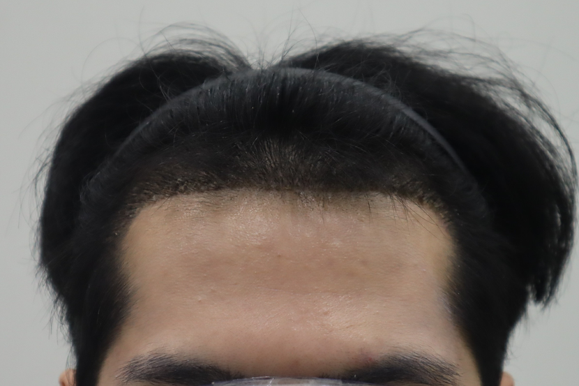 2주 후
