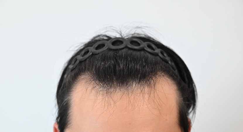 수술전