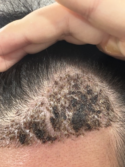 3일차