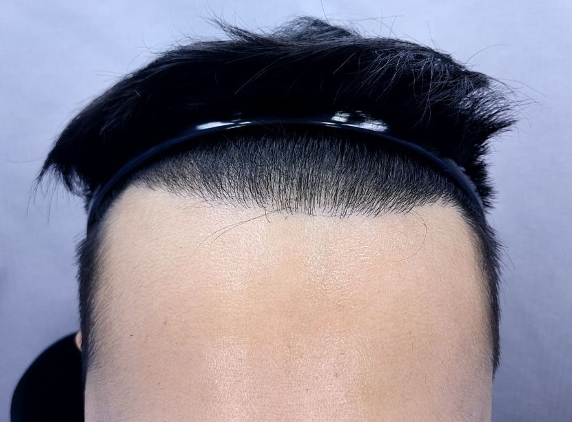 9개월후