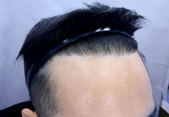 9개월후