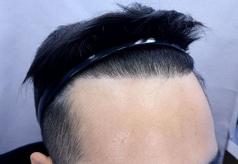 9개월후