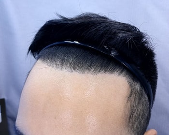 9개월후