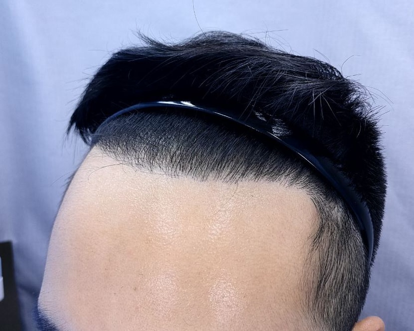 9개월후