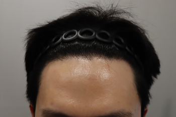 정면