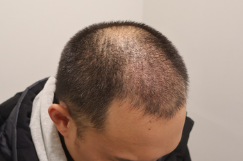 1개월