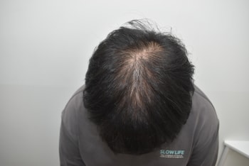 수술전 