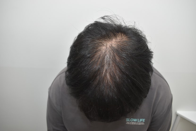 수술전 