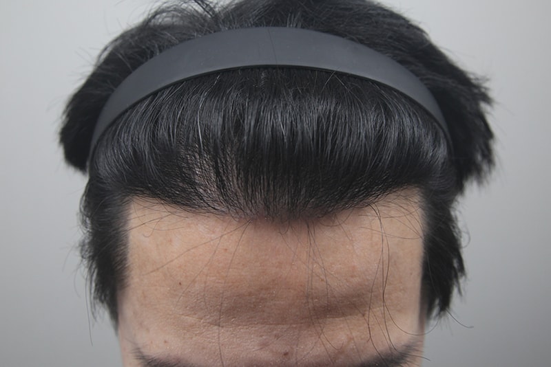 김대우-원장님께-5000모-받았어요-(4).JPG