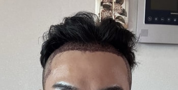1일