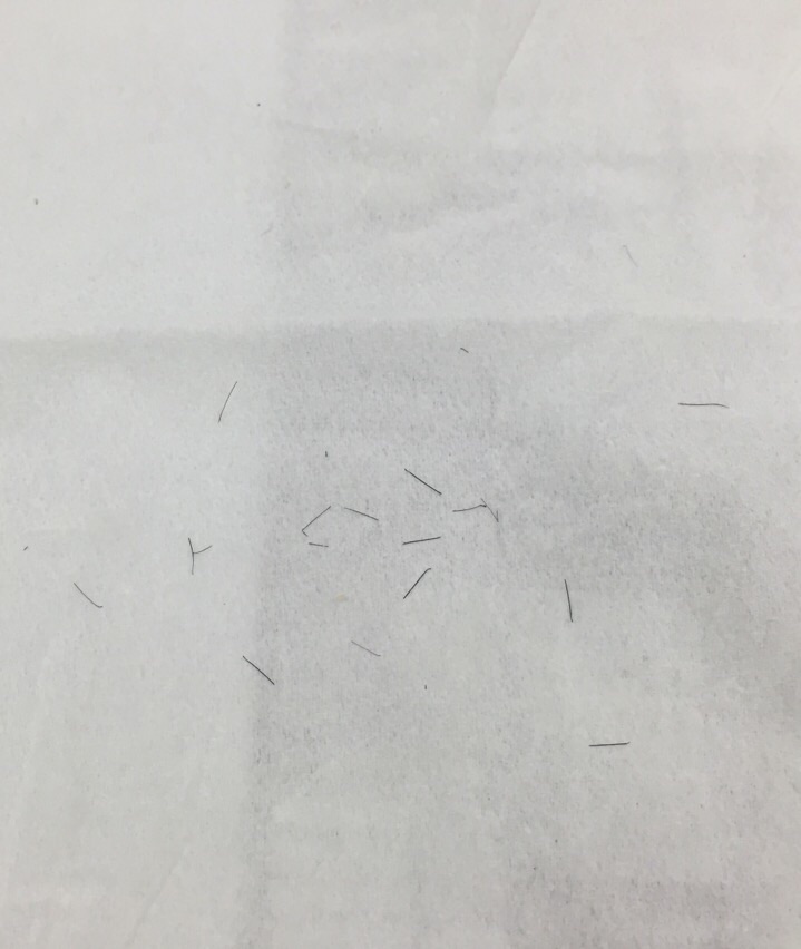 이식 한달차. 이식모 폭풍탈락ㅠ