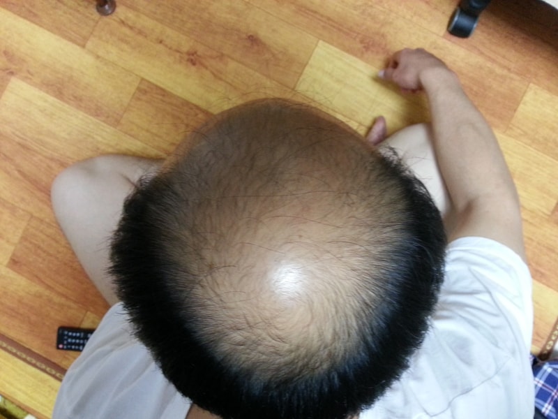 내일 합니다. 아자아자 아자자자..ㅎㅎ