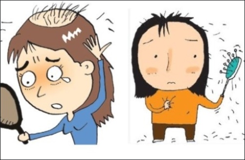 많은 분들이 궁금해 하시는 모발이식 잘하는곳