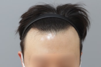수술전