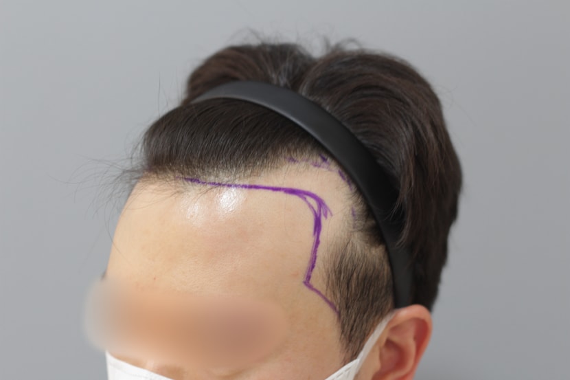 디자인