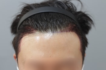 수술다음날