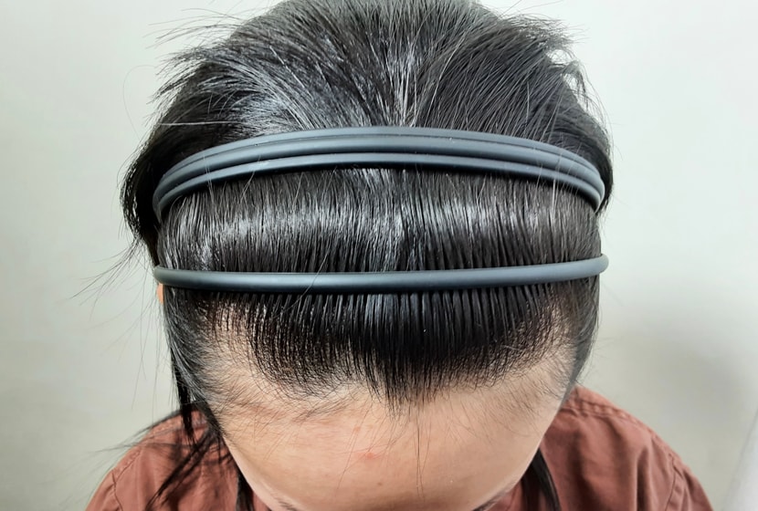수술전