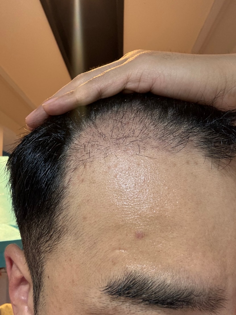 1개월