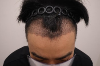 2주