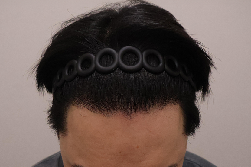 1년 경과 ^^