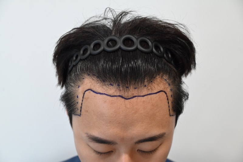 1000015640.jpg