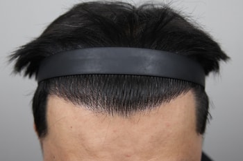 후